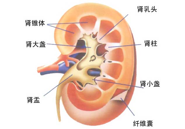 肾窦区结石图图片